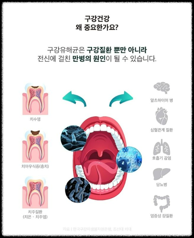 "덴티오클린" 구강 유산균 추천 이유는? 실제 복용자 후기 모음