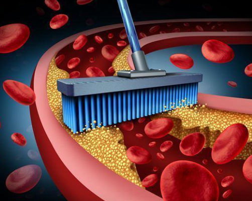 혈관청소