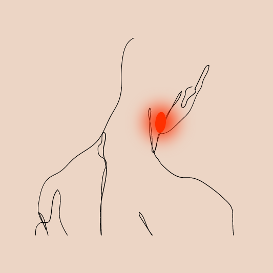 임파선염-이미지-예시