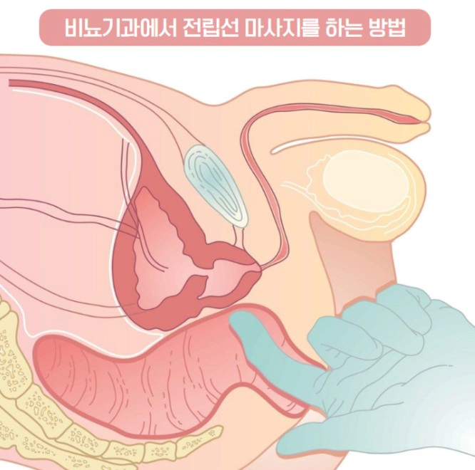 전립선 마사지의 기본 방법