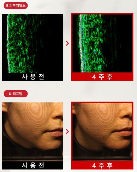고혼진-기미크림-효과