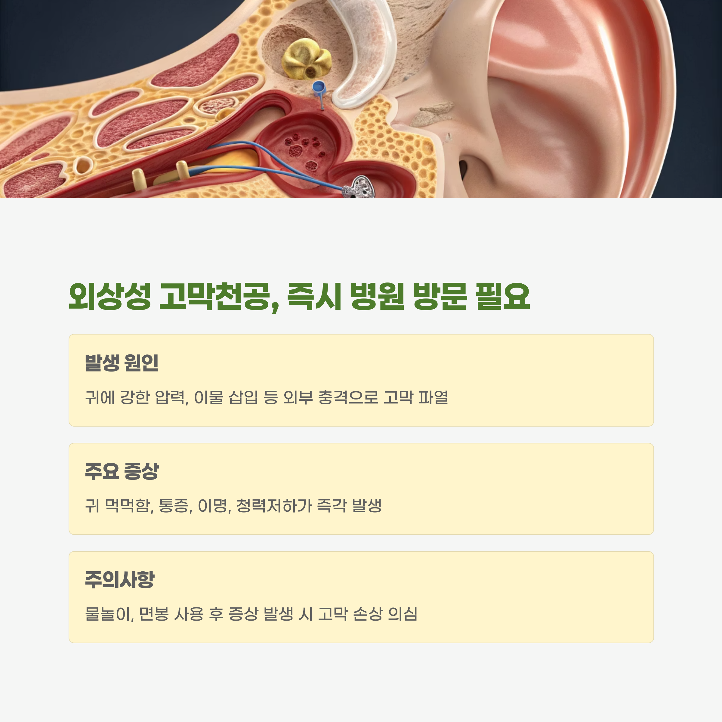 외상성 고막천공