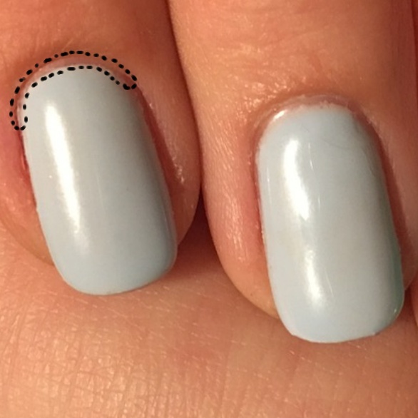 루즈스킨이 있는 곳을 표시