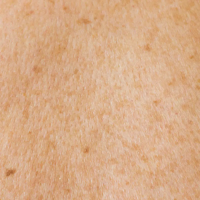 중년 여성 피부노화에 레티놀, 효과는? 부작용·사용법 총정리