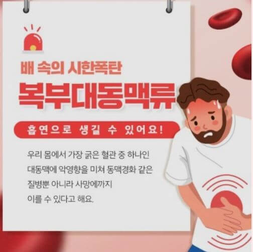 복부 대동맥류 증상과 원인 및 자가진단