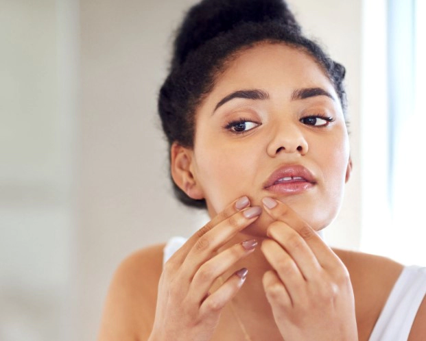 비립종 원인 생기는 이유 5가지