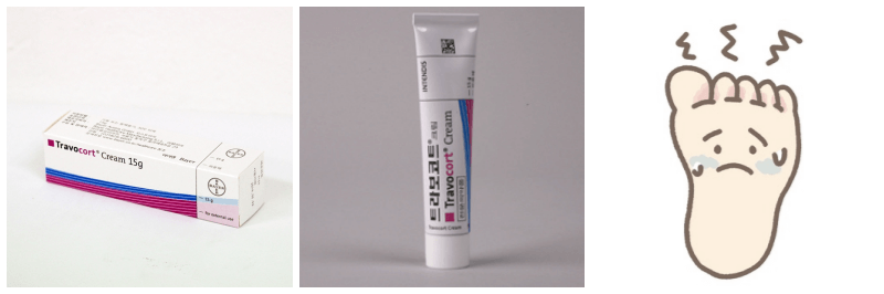 트라보코트 크림, 무좀 사진