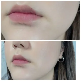 입술 밑 점 관상 참고 정보_11