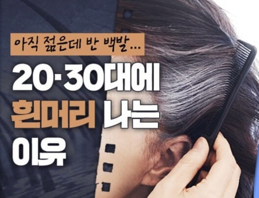 흰머리 느는 이유