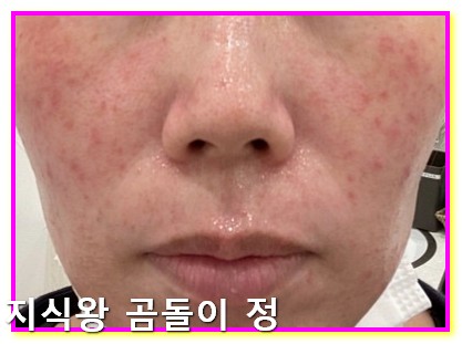 갱년기 관절통 수면장애 줄이는 하루 5단계 루틴 공개3