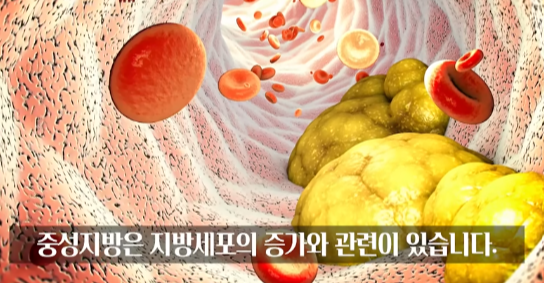  고지혈증 약 없이 건강한 혈관 만드는 법