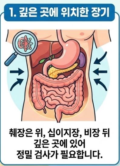 췌장암 검사방법