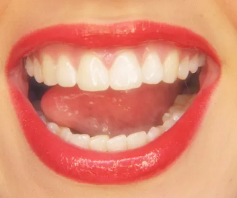 잇몸이-붓고-아플때-이유-해결방법-건강