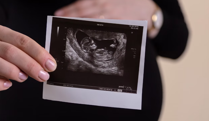 철분제 효능 : 태아