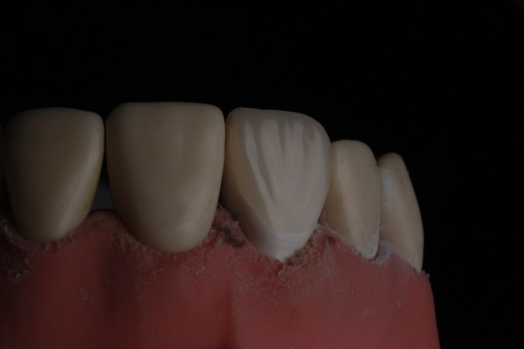 dentures