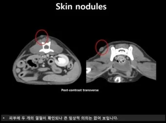 강아지 췌장암 증상 진단 치료법 안내_53