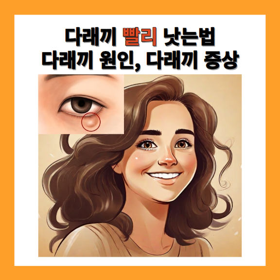 다래끼 빨리 낫는법