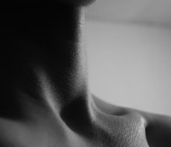 아토피 피부염 진단 기준 치료법 합병증