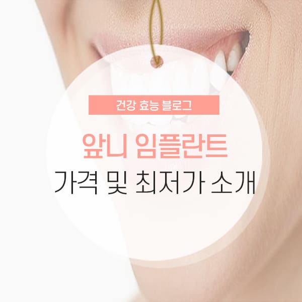 앞니 임플란트 가격 및 최저가 소개 콘텐츠