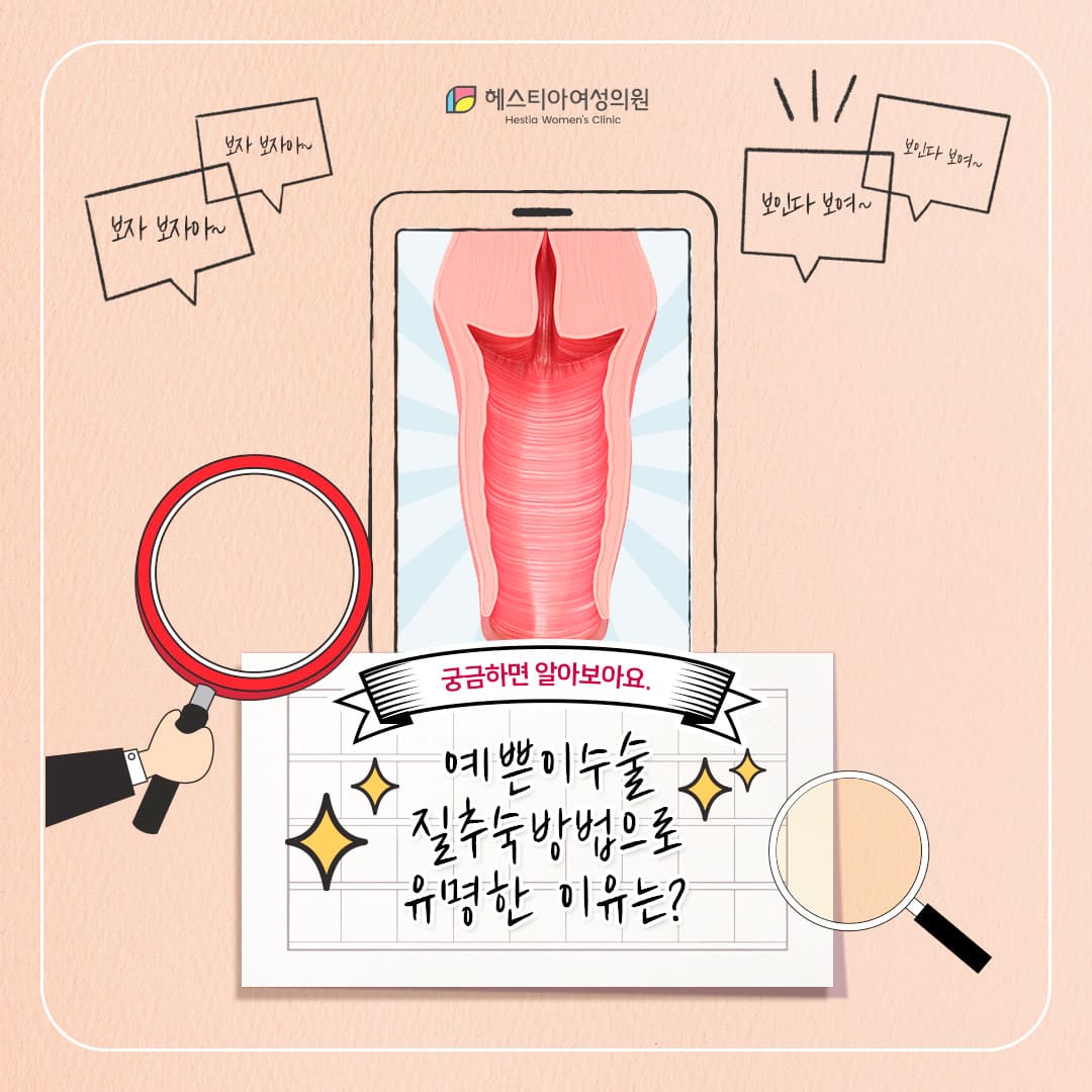 이쁜이수술 질탄력 개선 효과가 확실하다?