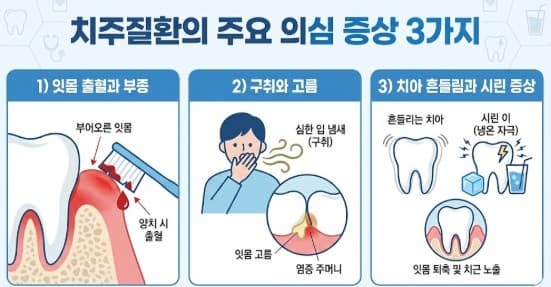 치주질환 주요 의심 증상 3가지에 대한 이미지