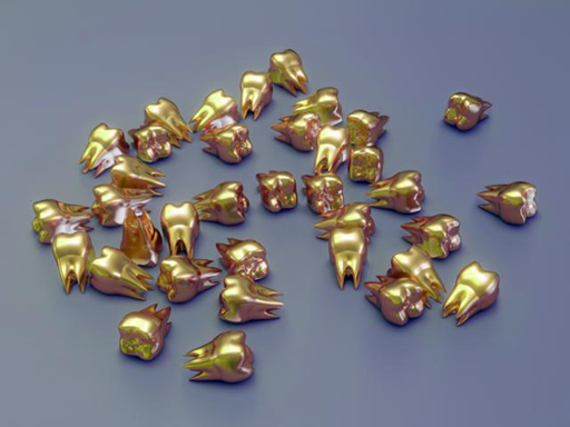 금니 팔기 전 시세 확인하기