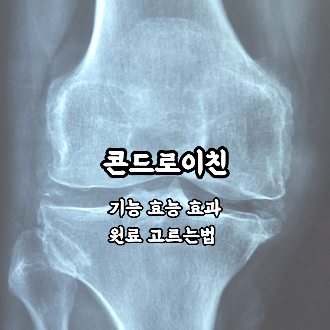 콘드로이친 기능 효능 효과 원료 고르는법 총정리