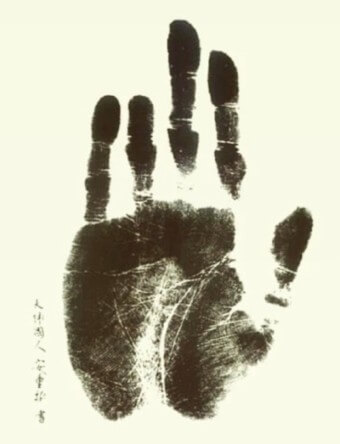 단지동맹으로-약지-한마디를-잘라낸-안중근-의사의-손바닥-사진