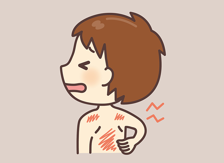 완전 피부 손상