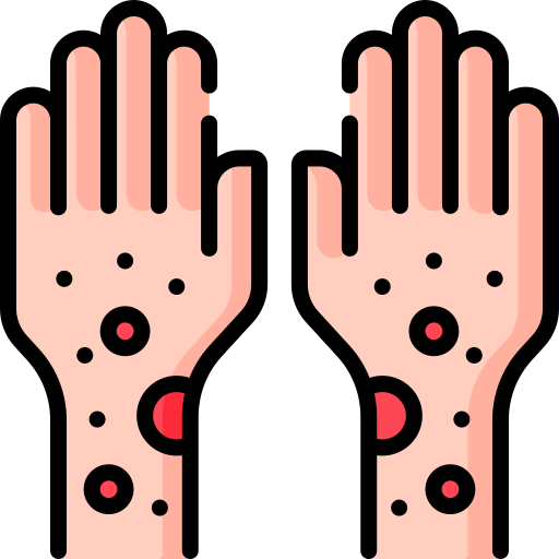 피부발진 종류 피부발진 원인 피부 붉은발진