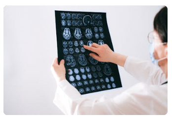 뇌졸증 원인, 증상, 치료, 예방, 질병코드 : 갑자기 찾아오는 불청객