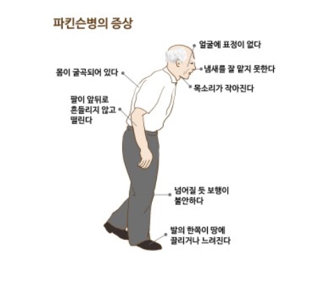 파킨슨병의 증상(출처 자생한방병원)