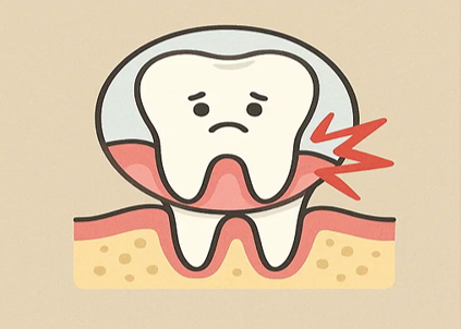 치아 시림의 원인을 설명하는 인포그래픽