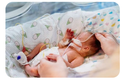 미숙아-특징-간호