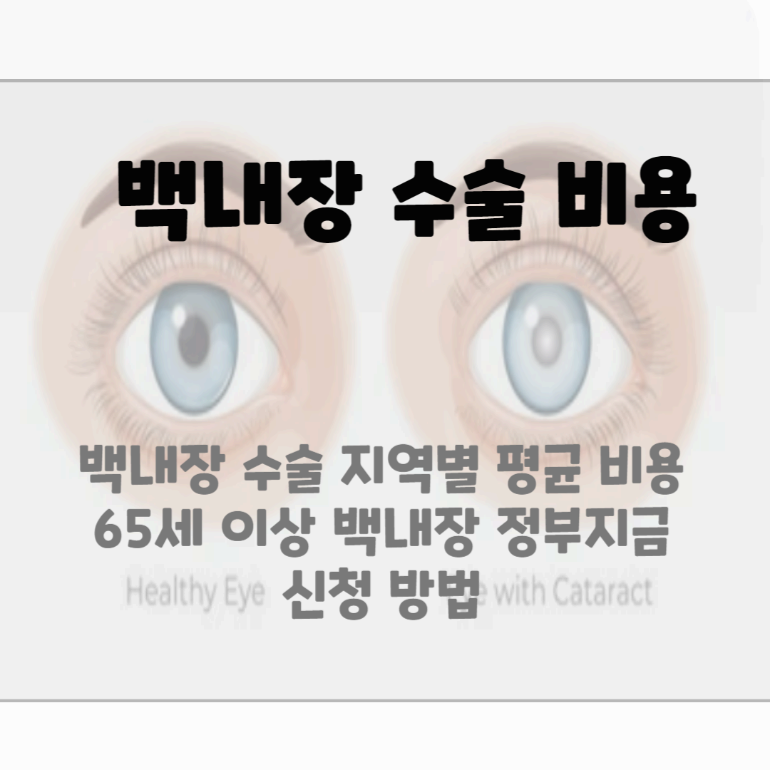 백내장 수술비용, 종류 블로그 썸네일 사진