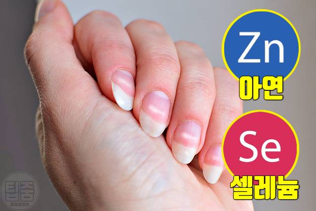 손톱 하얀 반점 손톱흰반점 손톱흰색가로줄 원인 아연 셀레늄 결핍