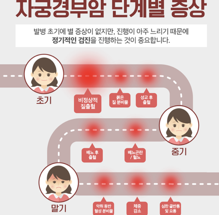 자궁경부암 증상 1