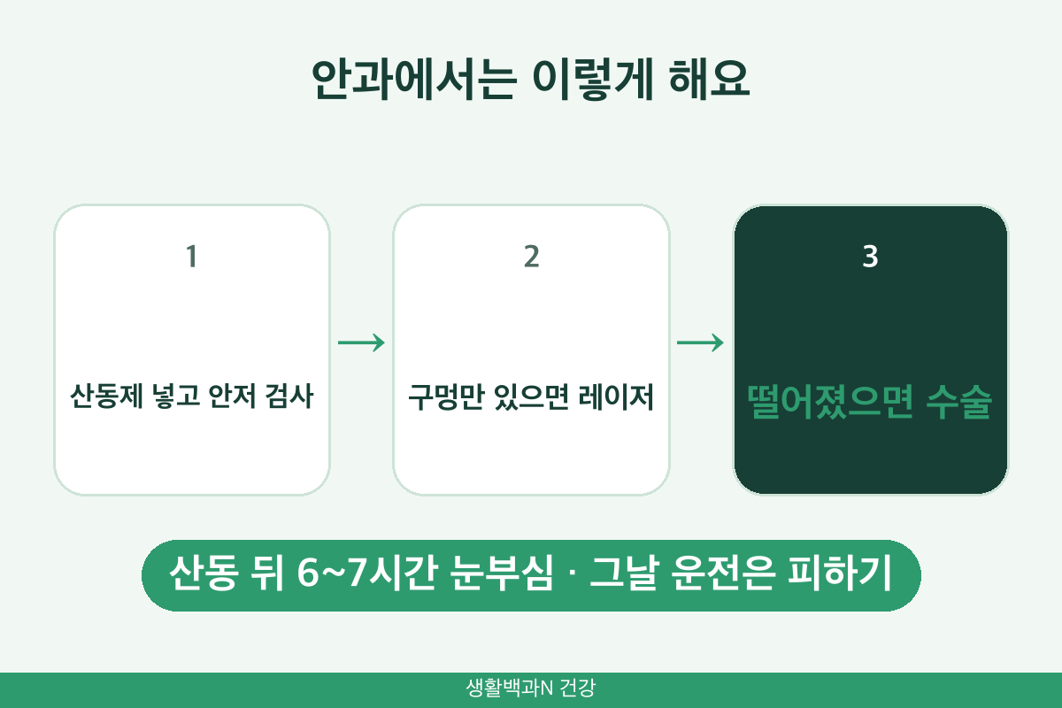 망막박리 검사 치료 정밀 산동 안저 검사 레이저 공막돌륭술 유리체 절제술