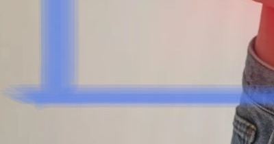 탈장이란, 증세