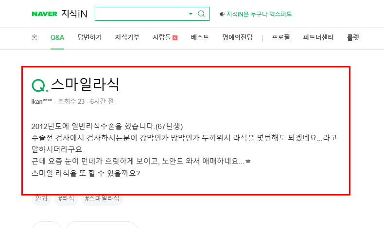 스마일 라식 질문