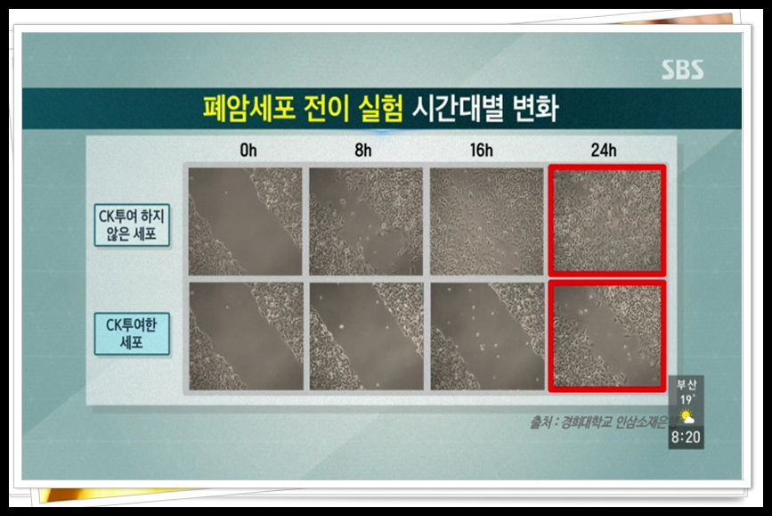 자궁경부암 반응성 세포변화