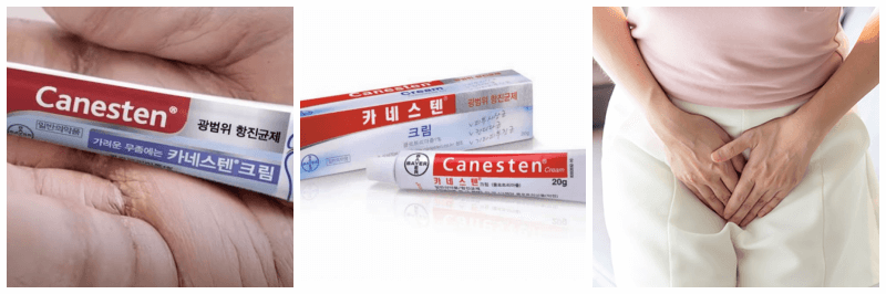 카네스텐 연고, 질염 사진