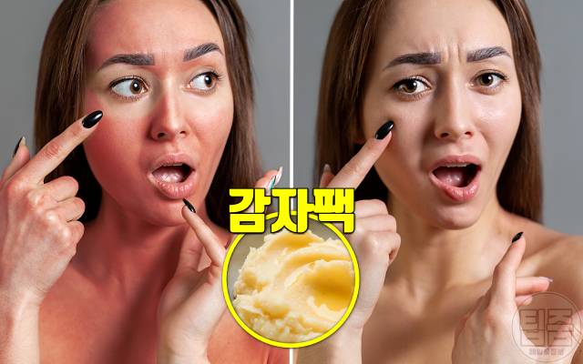 피부 탔을때 하얗게 얼굴 탄거 복구 감자팩
