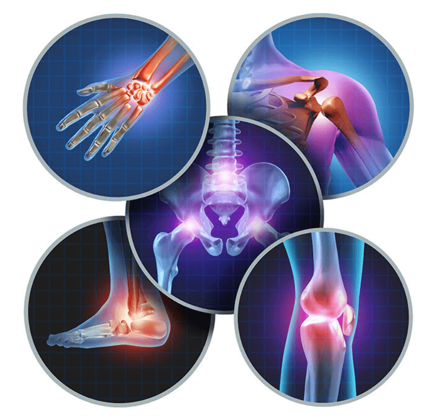 손가락-마디-무릎-어깨-고관절-발목-무릎-관절염-사진