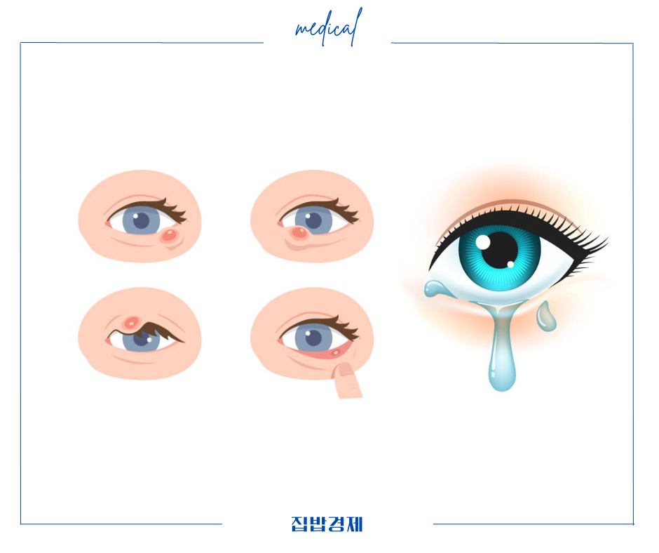 효과 및 부작용