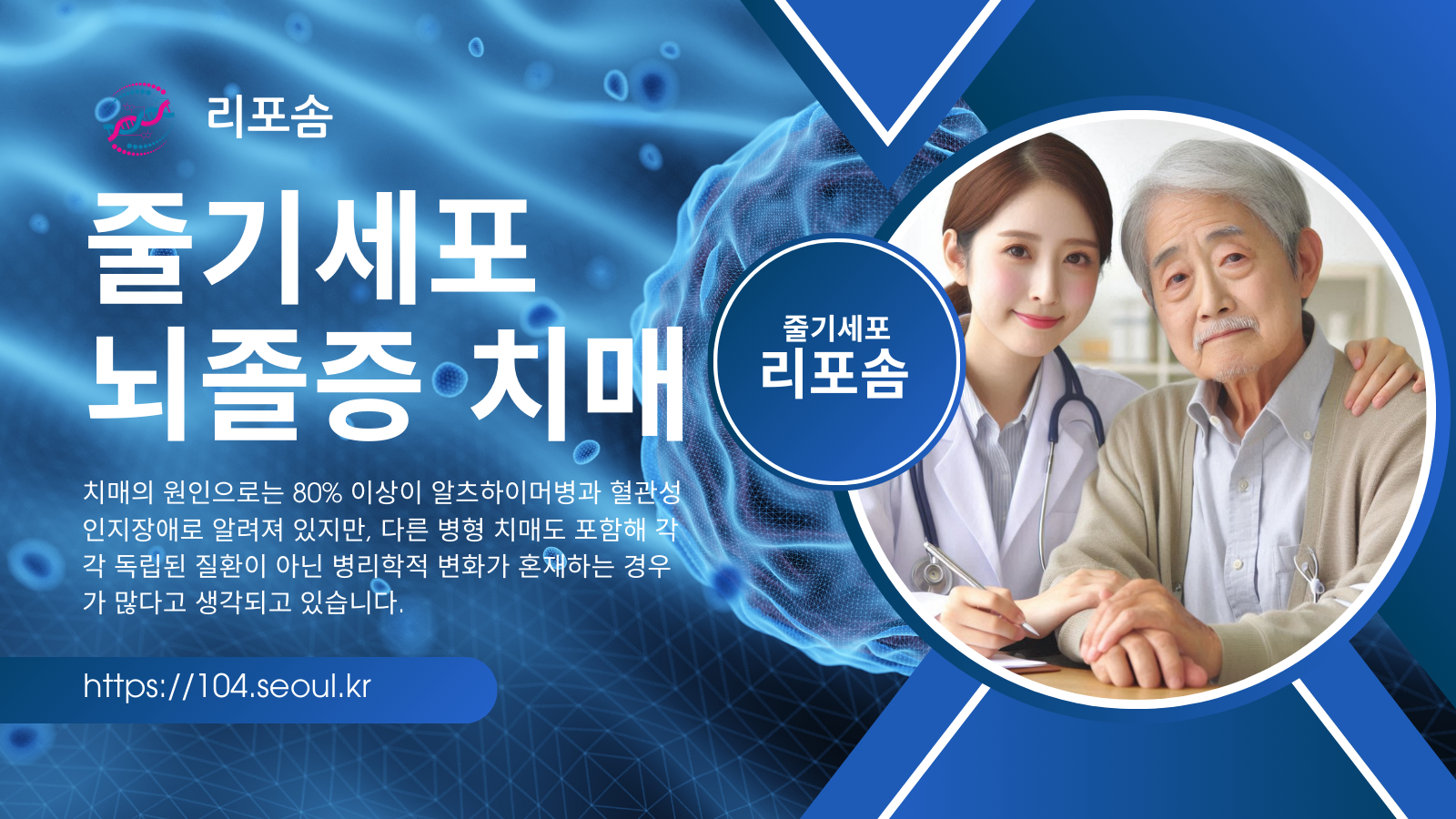 뇌졸중, 치매에 대한 줄기세포 치료에 대하여