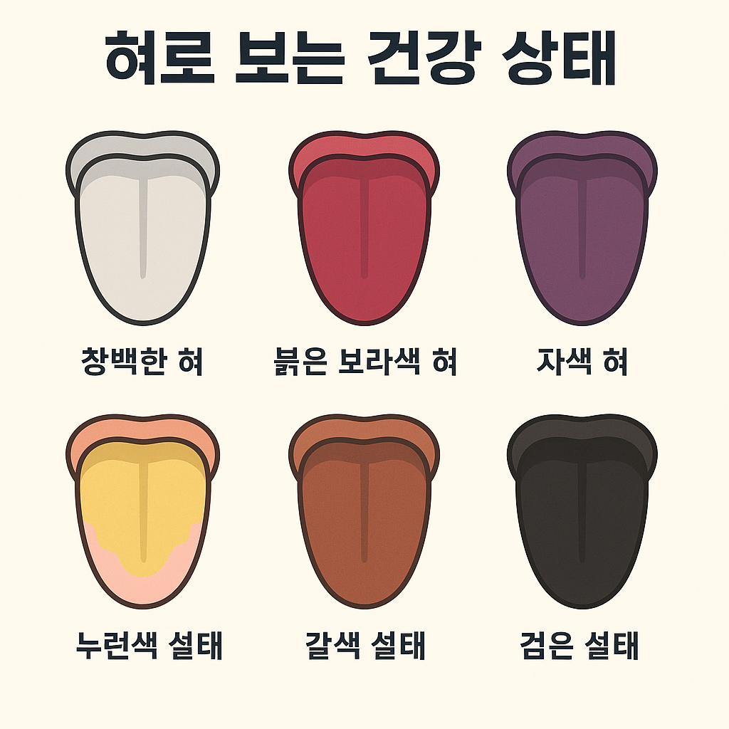 혀로 보는 건강 상태
