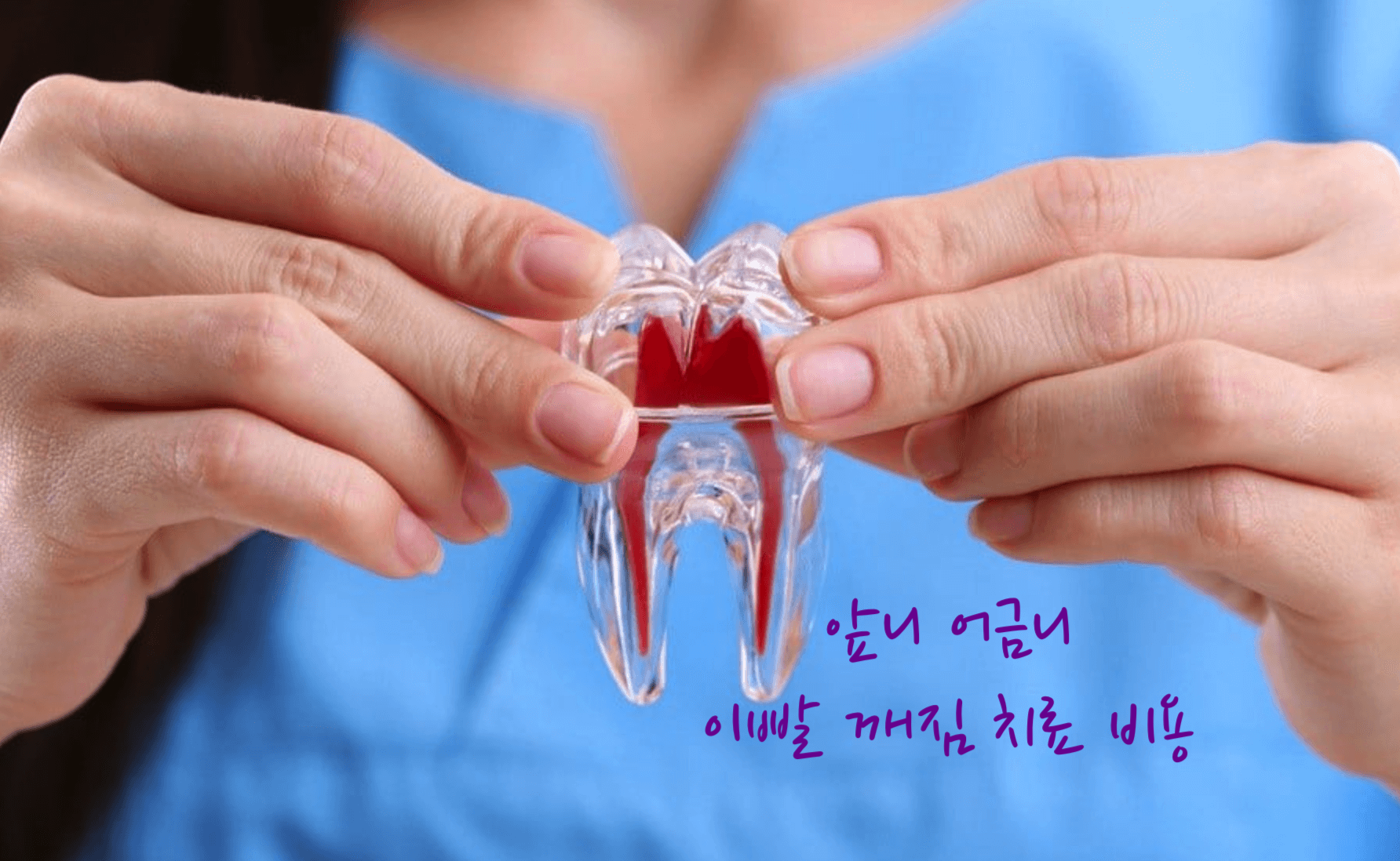 이빨 깨짐