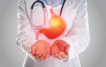 오메가3 효능 및 부작용, 주의점