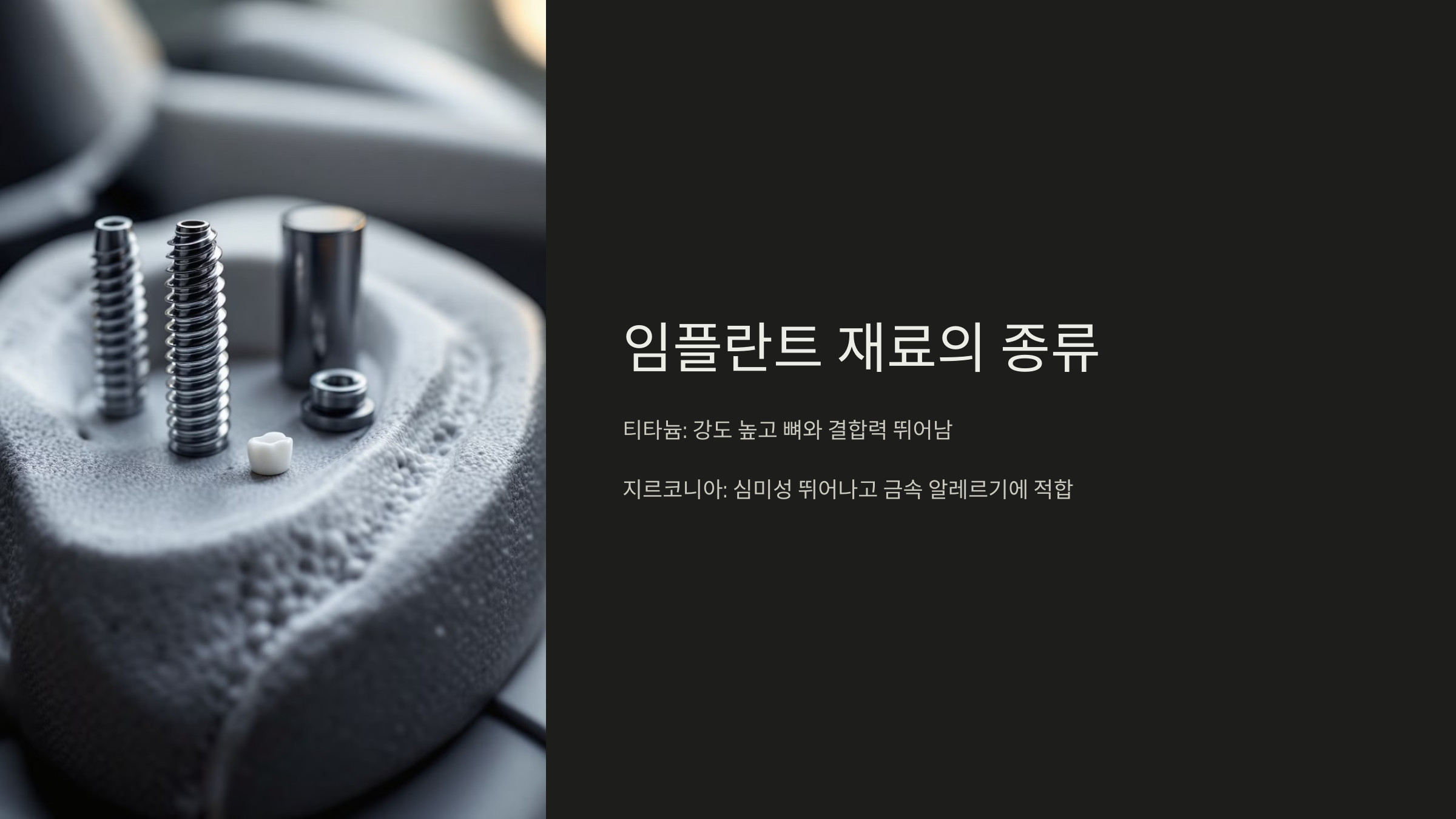 임플란트 재료의 종류